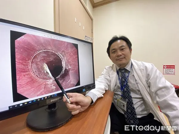 ▲▼義大醫院肝膽腸胃科主任王文倫提醒過年要注意魚刺卡喉嚨。(圖/記者陳宏瑞攝)