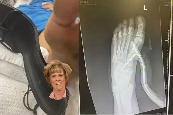 房間發現超大蜘蛛 25歲女跳下床崩潰「7cm高跟鞋」刺穿她左腳。(圖/翻攝自TikTok/alyssaalambert)