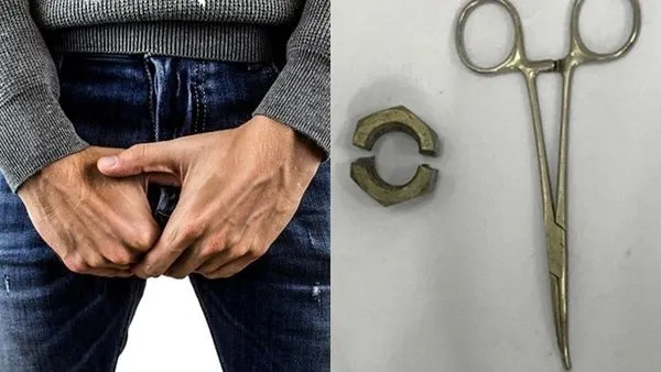 ▲▼越南一名男子將六角螺帽套用在陰莖上,導致陰莖腫脹、難以取下。(圖/取自Pixabay、美國NCBI)