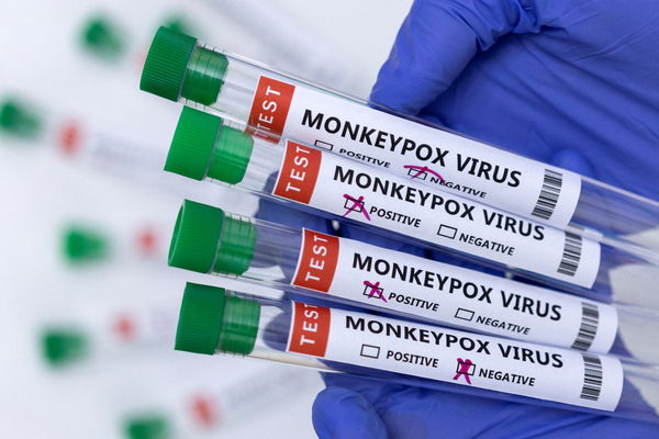 ▲▼猴痘、圖為標有猴痘病毒陽性和陰性的試管。（示意圖／路透）