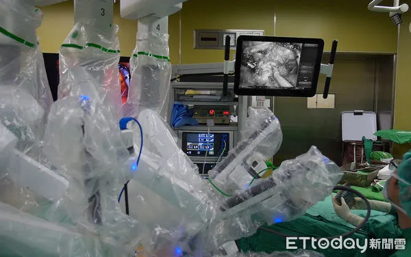 ▲▼ 嘉基達文西肛門手術-大腸直腸癌手術傷口少又小還能保肛。(圖/嘉義基督教醫院提供)