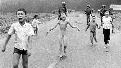 越戰50周年「燒夷彈女孩最後一次皮膚治療」　樂觀喊話：人生有了新風景