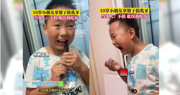 大陸山東一名男孩在吃飯時感到乳牙有些鬆動，因為影響到他吃飯，他便自己拿起鉗子開始拔牙。（圖／翻攝星視頻）