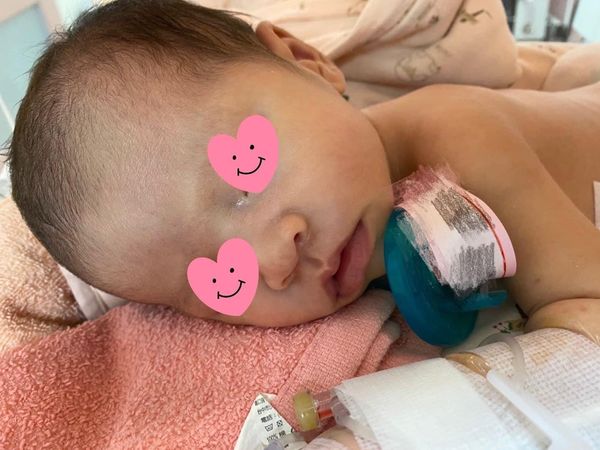 ▲▼1名未足月的女嬰左大腿骨折,家長心疼怒指院方虐待,烏日林新表示,檢調已在調查。(圖/爆料公社提供,下同)