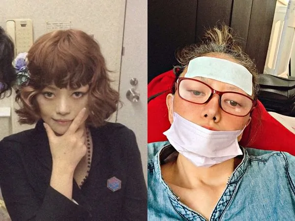 ▲▼廣田玲央名1年前罹肺癌,切除4分之1肺部。(圖/翻攝自部落格/廣田玲央名)