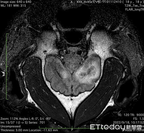 團團癲癇MRI檢查。（圖／台北市立動物園提供）