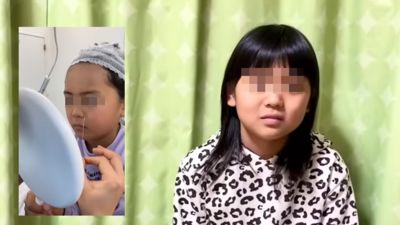 日本媽出錢「送9歲女兒去割雙眼皮」被炎上　網友和專家都搖頭