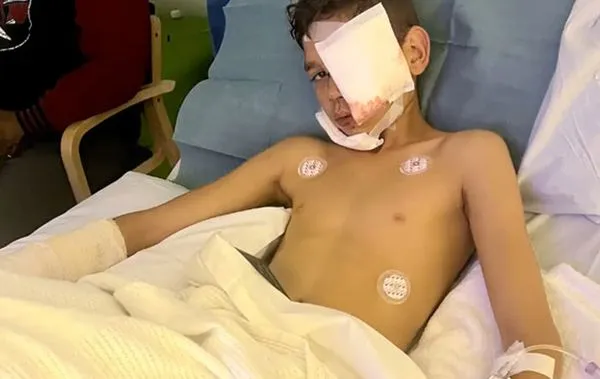 員警放任警犬亂咬人 13歲男被撲倒在地「臉部扯下大塊皮膚」。(圖/翻攝自Facebook)