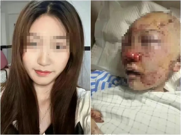 ▲▼20歲抖音網美女廁被埋伏 磚頭暴打20分「摳眼拔舌」滿頭血癱倒。(圖/翻攝抖音)