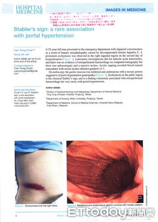▲屏基胃腸肝膽科主治醫師蔡元榮 。(圖/屏基提供,下同)