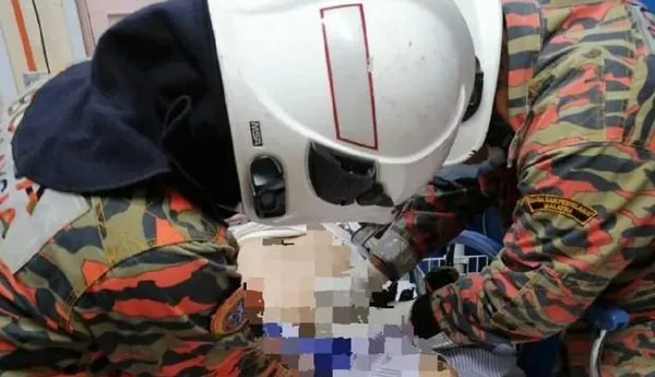 ▲▼馬來西亞一名男子陰莖被戒指卡住,導致消防員必須出動大剪刀替他進行切割。(圖/翻攝自江沙消防局官網)