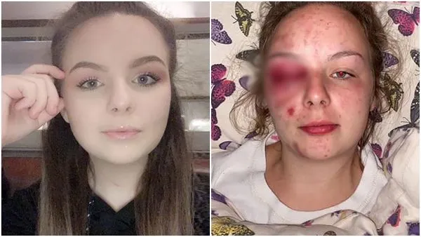 ▲▼英國坎布里亞郡(Cumbria)少女艾莉諾(Eleanor Williams)自爆是亞裔性犯罪集團的受害者,結果被揭穿都是捏造的。(圖/翻攝臉書)