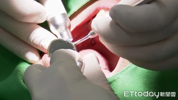 ▲▼過年,吃美食, 牙齒危機,牙齒保健,刷牙,看牙,牙科診所。(圖/記者姜國輝攝)