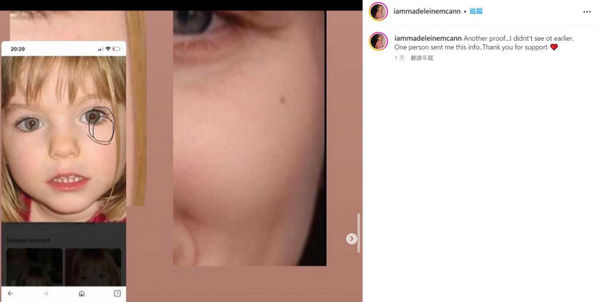 女子聲稱她的腿上有雀斑,眼睛上有一個斑點「和瑪德琳一樣」。(圖/翻攝自@iammadeleinemcann IG )