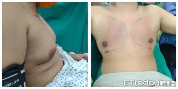 ▲怕被發現「B罩杯」泳課翹課狂被當,台中男崩潰求醫。(圖/記者游瓊華攝)