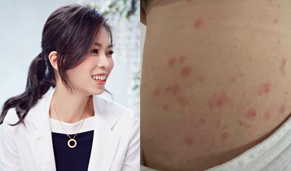 ▲▼ 。(圖/翻攝自Facebook/皮膚科日常菡養 高珮菡醫師)
