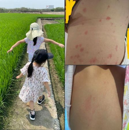 ▲▼ 。(圖/翻攝自Facebook/皮膚科日常菡養 高珮菡醫師)