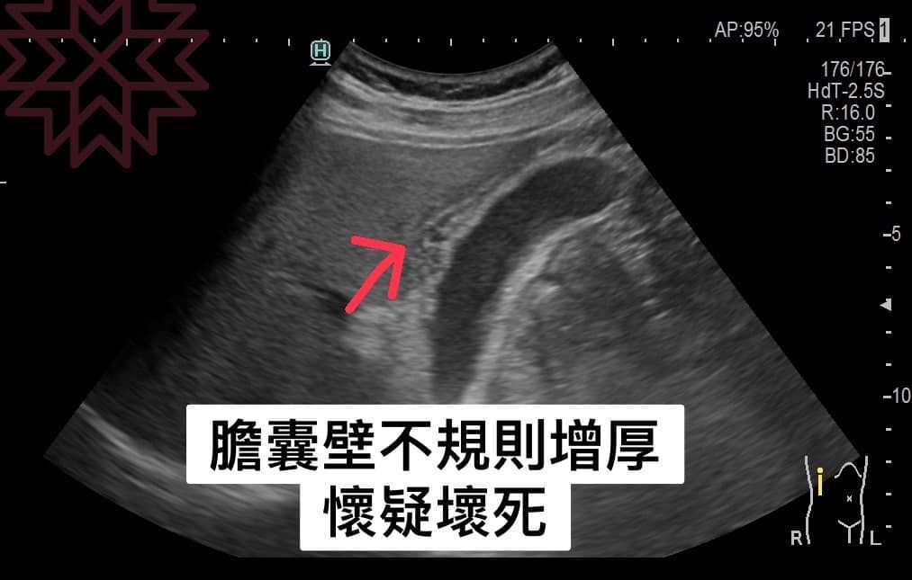 (圖/翻攝林相宏臉書)