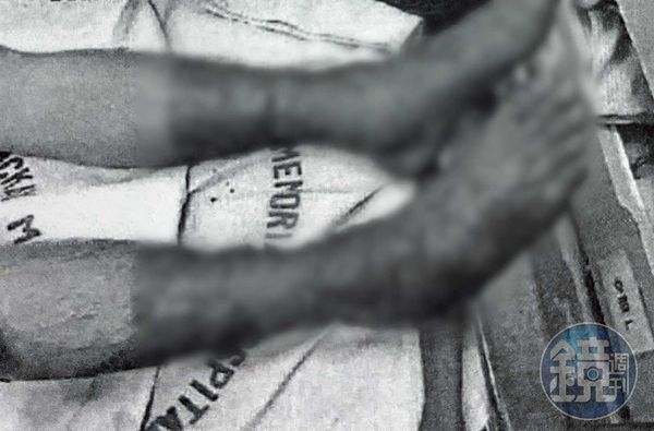 張男送醫時,2隻小腿的組織已嚴重壞死,慘不忍睹。(翻攝畫面,照片已經霧化處理)