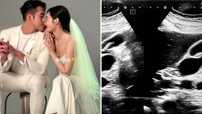 舒子晨結婚1年「尪突PO超音波照」！她秒轉發…親揭懷孕真相：放過我