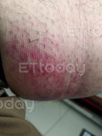 ▲▼ 中捷英勇奪刀黑衣男傷勢曝 。(圖/民眾提供)