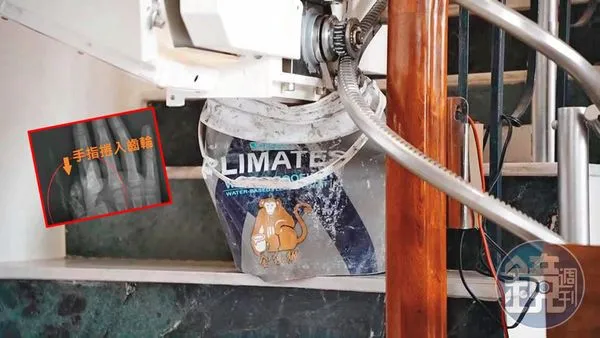 吳小姐購買樓梯升降椅,為了讓長輩方便上下樓梯,卻因產品瑕疵,造成幼童的大拇指遭壓斷。(讀者提供)