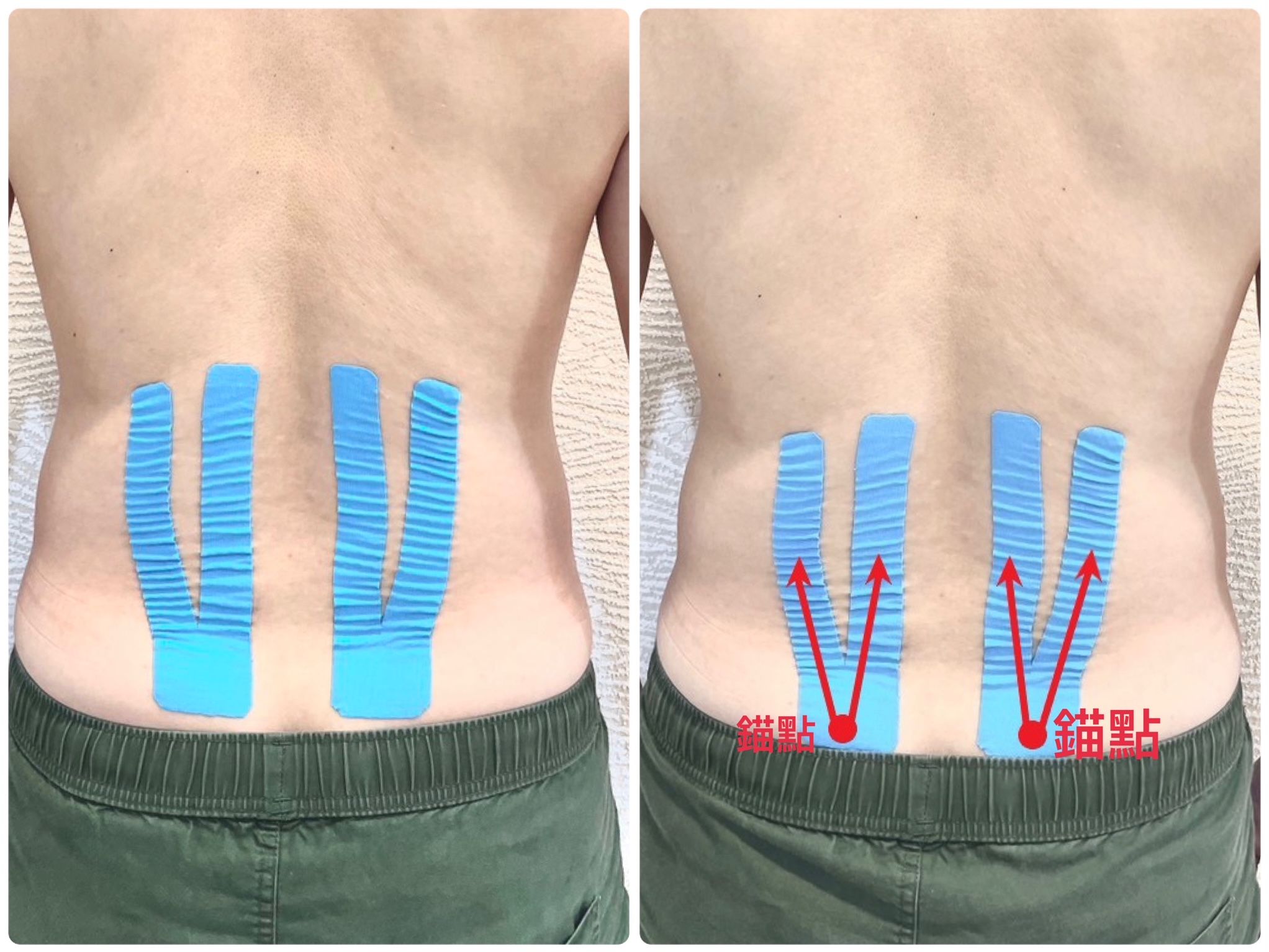 ▲▼春節症候群,貼紮,放鬆。(圖/鄒佳和提供)