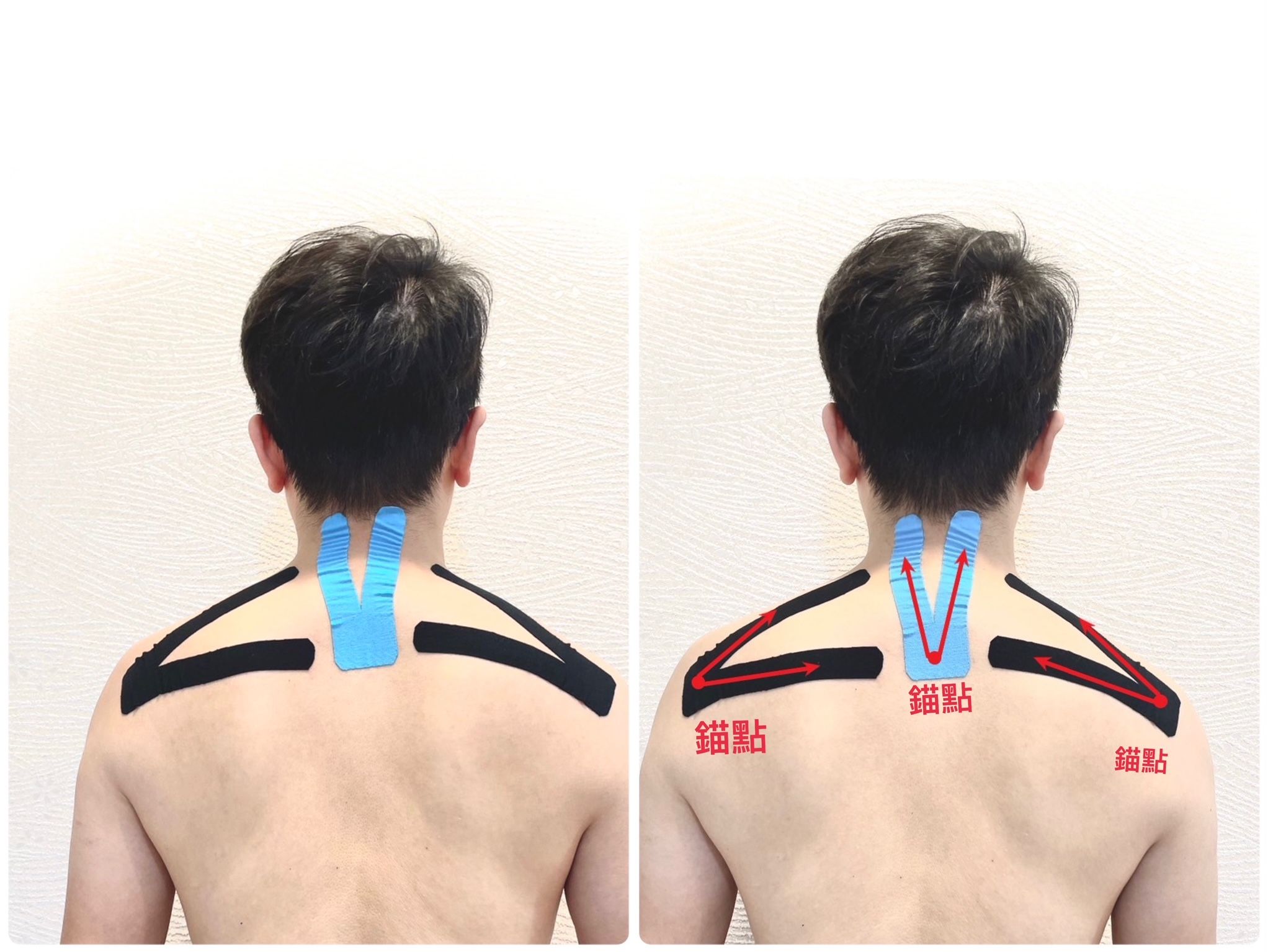 ▲▼春節症候群,貼紮,放鬆。(圖/鄒佳和提供)