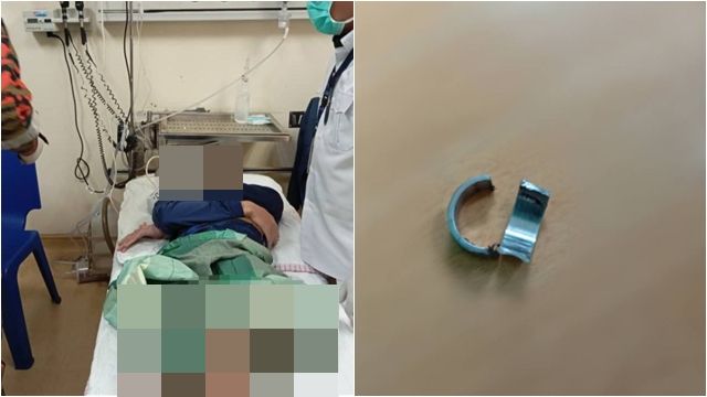 ▲▼GG套戒指卡死!鐵剪「喀擦」一聲 消防員傻眼:差點壞掉。(圖/翻攝亞羅士打消拯局)