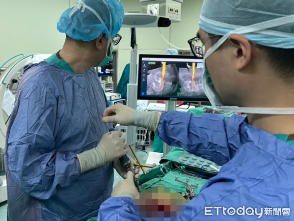 ▲▼北醫附醫精準3D導航微創脊椎手術。(圖/北醫提供)