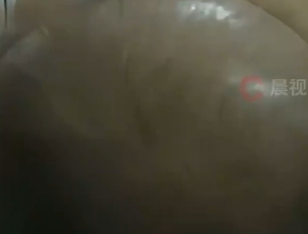 ▲▼男子一個月染4次髮,慘變大禿頭。(圖/翻攝自瀟湘晨報)