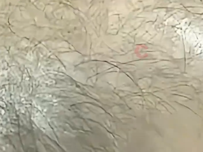 ▲男子最終的落髮情況。(圖/翻攝自瀟湘晨報)