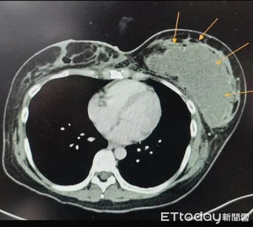 ▲▼ 馬偕醫院 。(圖/記者邱俊吉攝)
