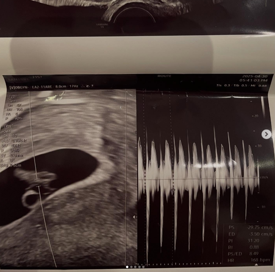 ▲徐敏在懷孕後被男友斷聯。(圖/翻攝自徐敏在IG)