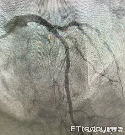 AI輔助心電圖檢測服務。(圖/北市聯醫提供)