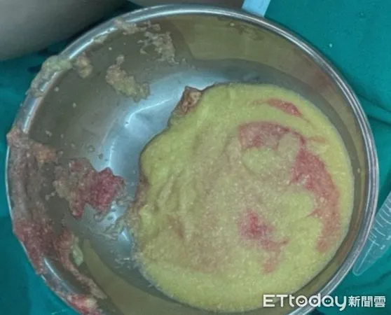 ▲▼ 馬偕醫院 。(圖/馬偕醫院提供)