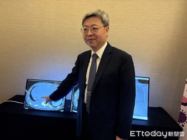 ▲▼感染管制學會與感染症醫學會示警抗生素抗藥性問題,新竹台大分院新竹醫院副院長盛望徽。(圖/記者洪巧藍攝)