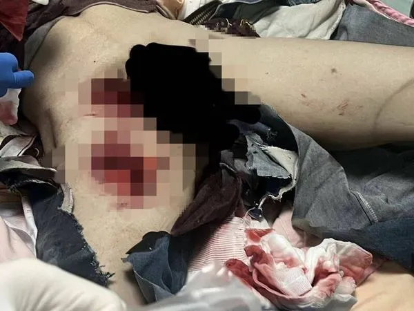 ▲彰化裝修工人在切割時意外傷到自己。(圖/民眾提供)