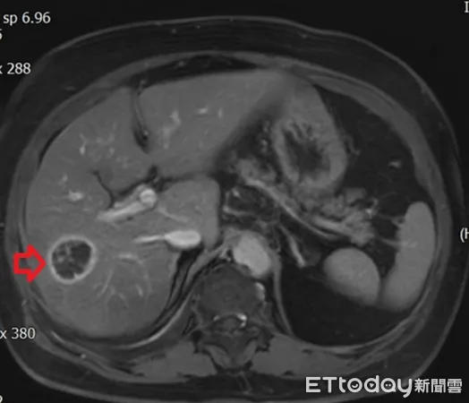 台北慈濟醫院胃腸肝膽科醫師陳泓達。(圖/醫師提供)