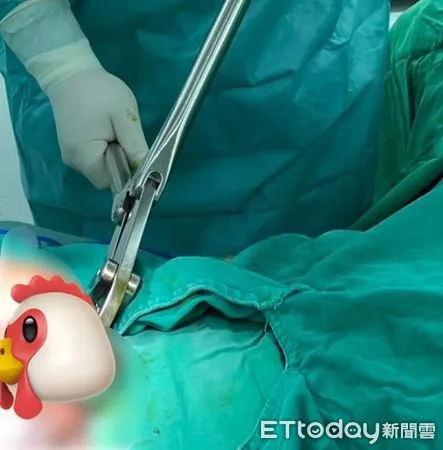 醫師動用骨科器械剪掉陰莖環。(圖/醫師提供)