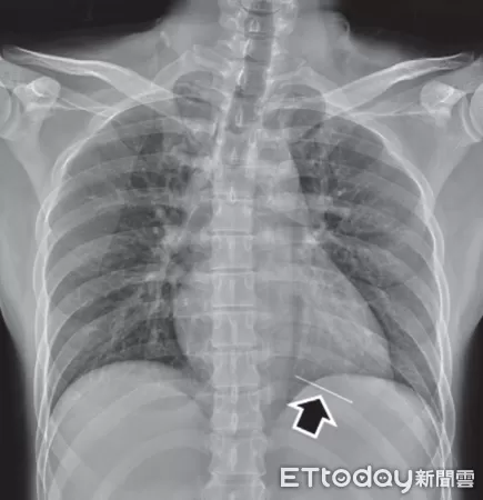 ▲▼ 天晟醫院 。(圖/賴雨濃醫師提供)