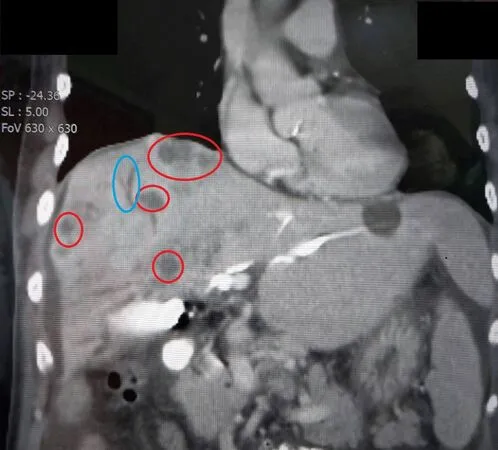 ▲▼吳家慶醫師提醒,當出現膽管癌警訊時,一定要及早就醫,千萬不可輕忽。(圖/大千醫院)