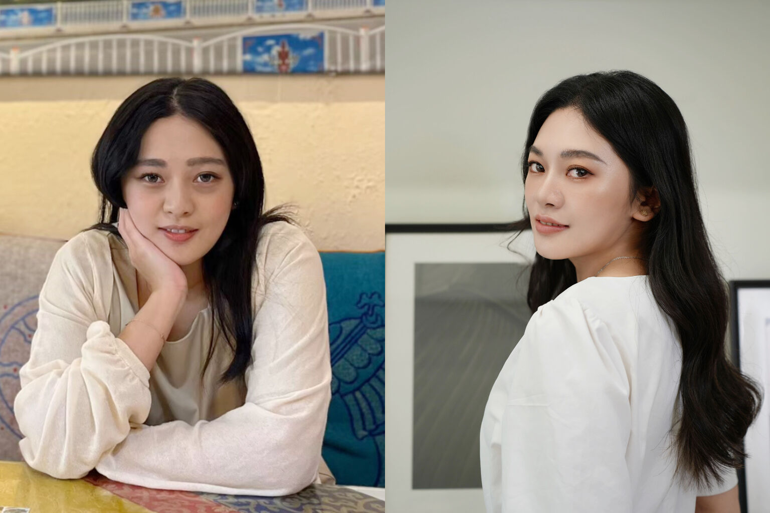 ▲▼美加醫美,眼袋,4D精密眼袋撫平術,電波,音波,玻尿酸。(圖/業者提供)