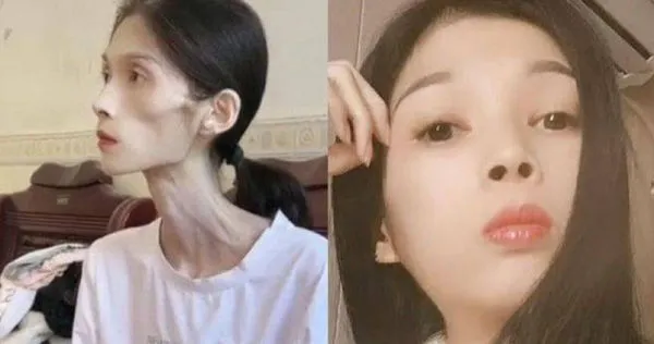 幾年前的巧巧還是一位容貌出眾、氣質溫婉的女子,與如今這副枯槁的模樣判若兩人。(圖/翻攝自微博)