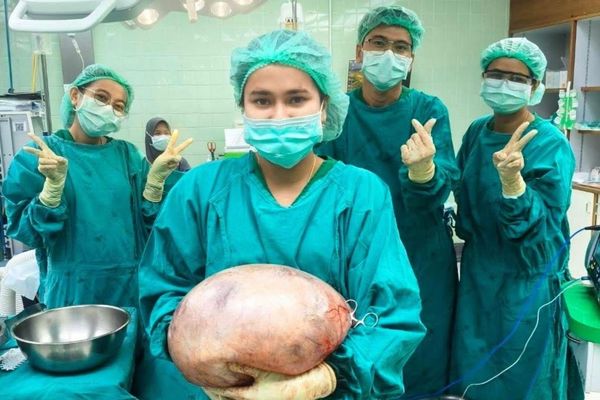 泰妹長期小腹隆起,肚內竟藏1顆重達8公斤超大卵巢囊腫。(翻攝自臉書คลินิกสูตินรีเวชหมอธมน สตูล)