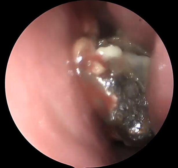 (圖/翻攝「陳亮宇醫師 / 陳亮宇耳鼻喉科診所」臉書)