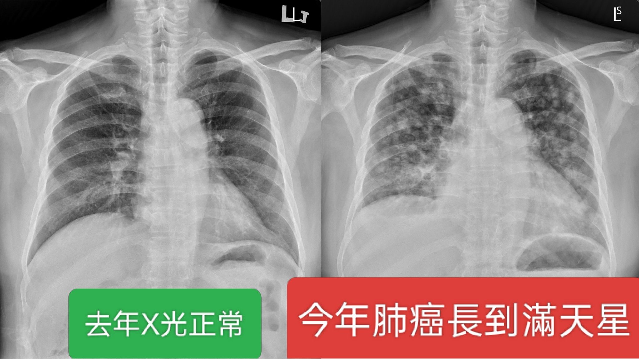 (圖/翻攝蘇一峰臉書)