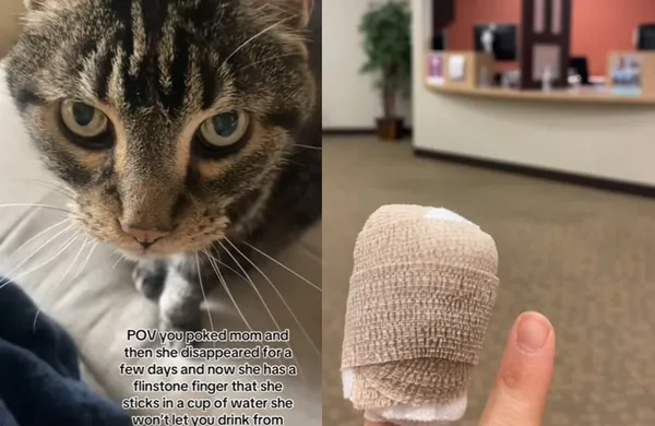 寵物貓爪意外刺進指甲縫 女幾天後被送進急診被迫「拔除指甲」。(圖/翻攝自TikTok/imkaramarie)