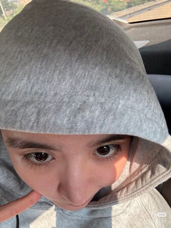 ▲▼《青春有你2》金子涵被發現「手腕多條疤」。(圖/翻攝自小紅書/金子涵Iris)