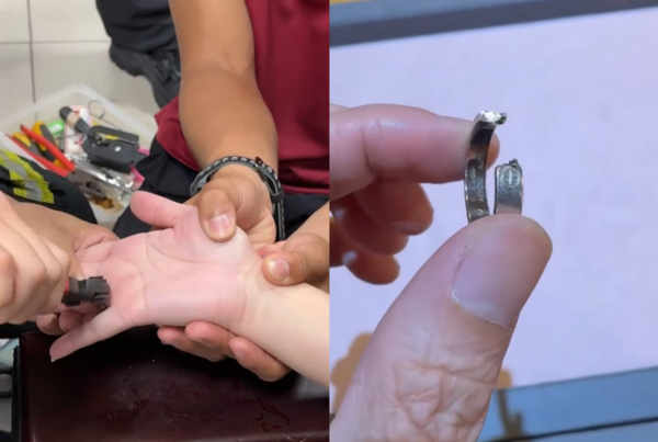 ▲▼前主播黃馨儀喝醉1舉動「手指腫成豬頭」。(圖/翻攝自Instagram/cindy1020)